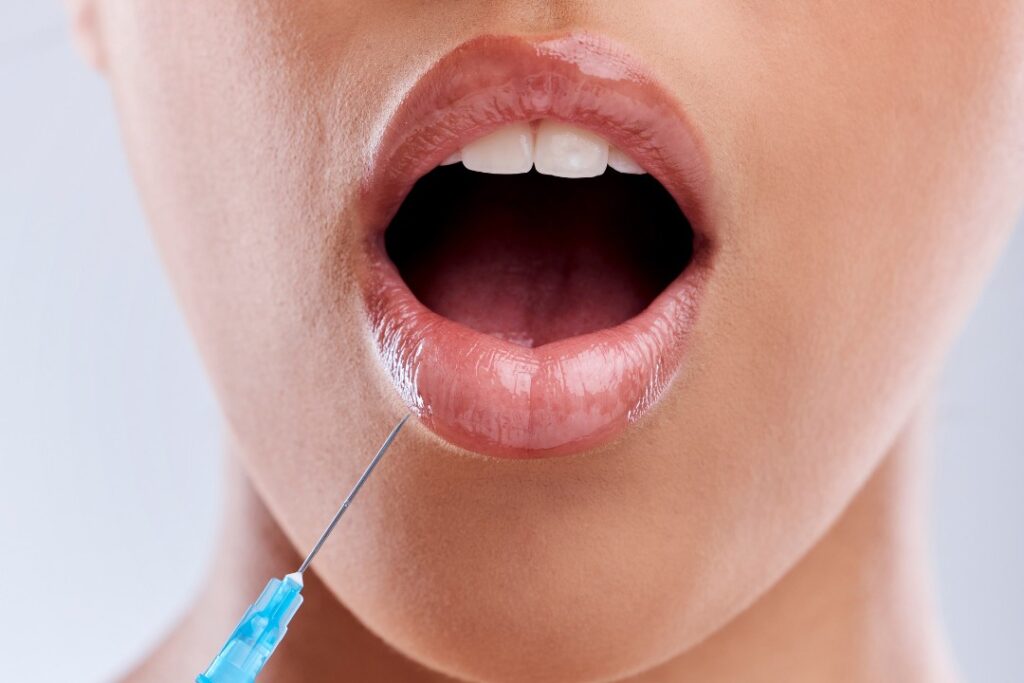 medspa patient surprised after learning how much is lip filler