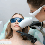 laser hair removal