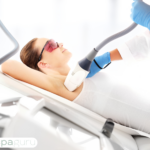 laser hair removal